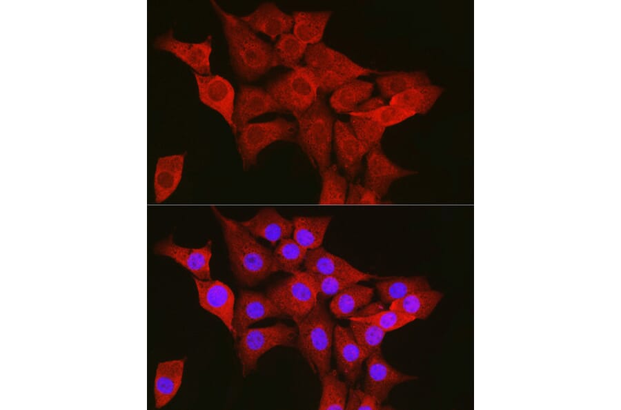Immunofluorescence - Anti-TTK/Mps1 Antibody (A14012) - Antibodies.com