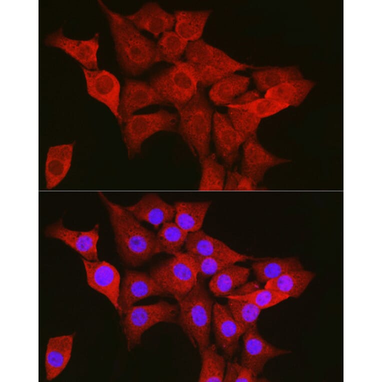 Immunofluorescence - Anti-TTK/Mps1 Antibody (A14012) - Antibodies.com