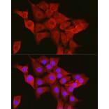 Immunofluorescence - Anti-TTK/Mps1 Antibody (A14012) - Antibodies.com