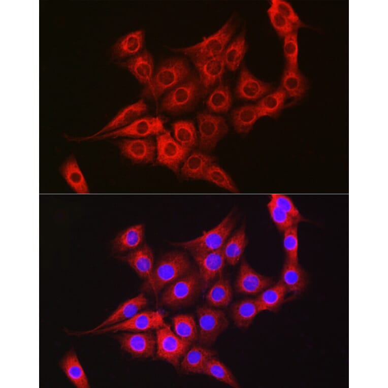 Immunofluorescence - Anti-TTK/Mps1 Antibody (A14012) - Antibodies.com