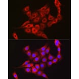 Immunofluorescence - Anti-TTK/Mps1 Antibody (A14012) - Antibodies.com