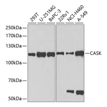 Western Blot - Anti-CASK Antibody (A14013) - Antibodies.com