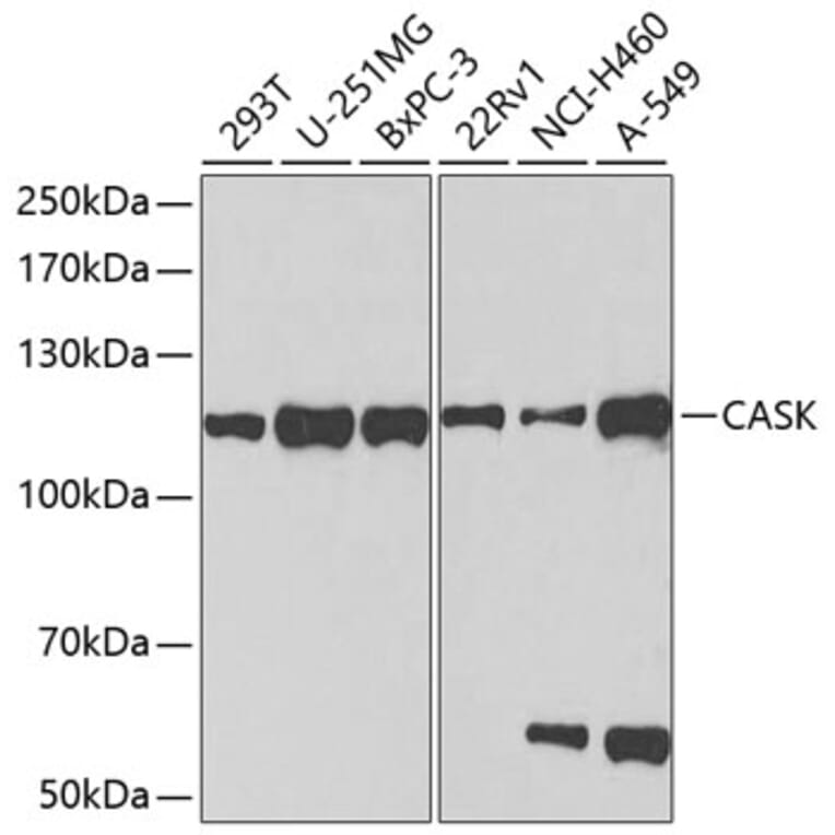 Western Blot - Anti-CASK Antibody (A14013) - Antibodies.com