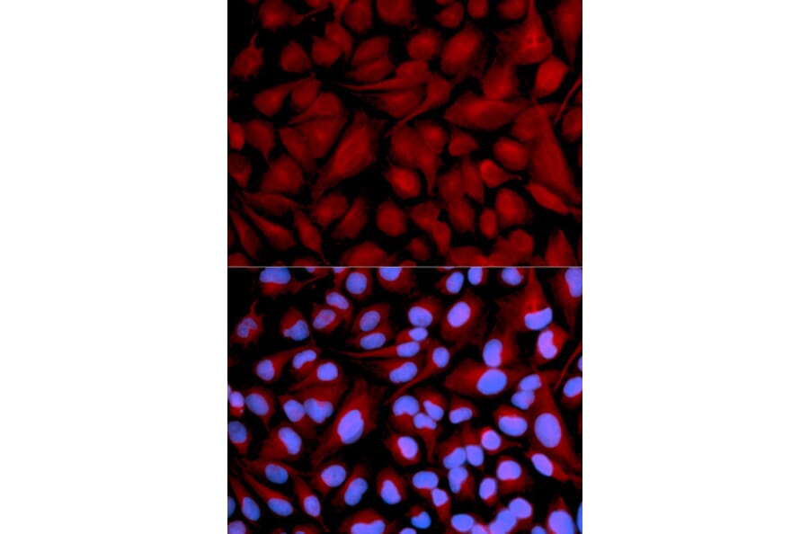 Immunofluorescence - Anti-CASK Antibody (A14013) - Antibodies.com