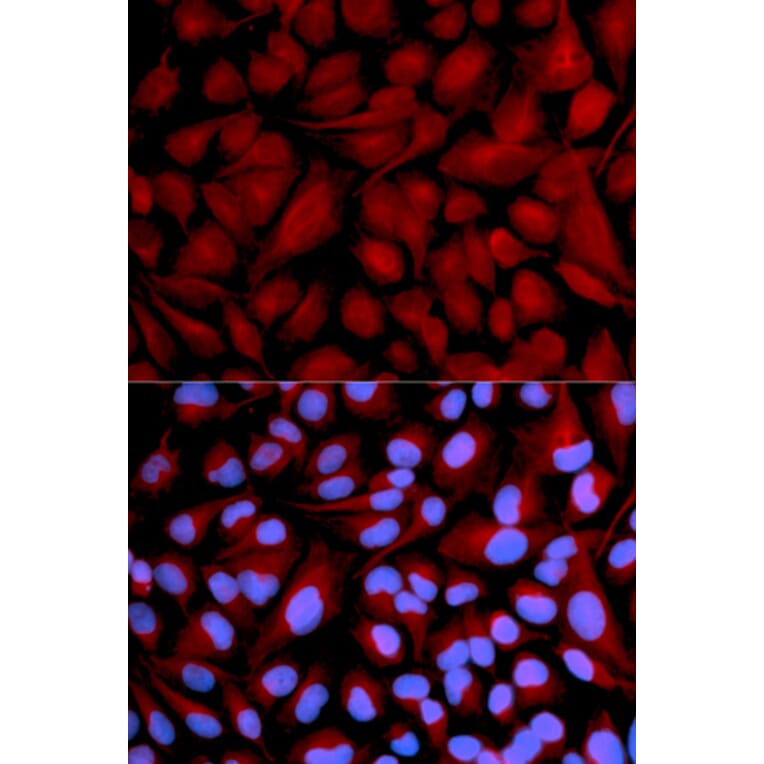 Immunofluorescence - Anti-CASK Antibody (A14013) - Antibodies.com