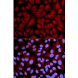 Immunofluorescence - Anti-CASK Antibody (A14013) - Antibodies.com