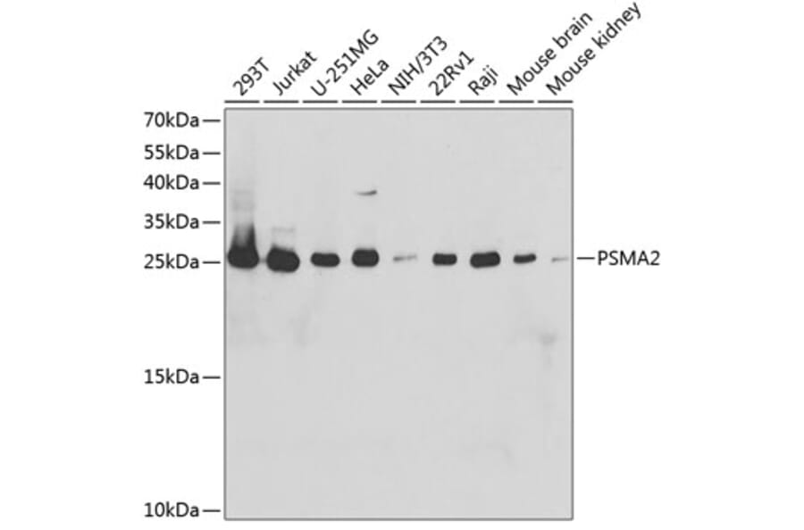 Western Blot - Anti-Proteasome 20S alpha 2/HC3 Antibody (A14015) - Antibodies.com
