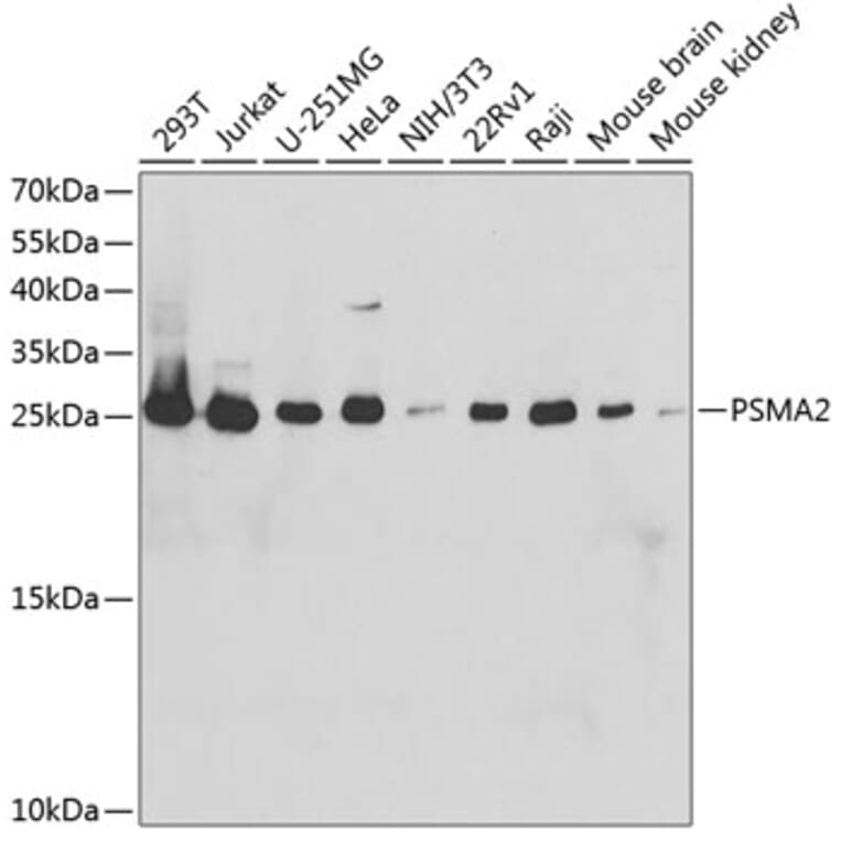 Western Blot - Anti-Proteasome 20S alpha 2/HC3 Antibody (A14015) - Antibodies.com