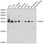 Western Blot - Anti-Proteasome 20S alpha 2/HC3 Antibody (A14015) - Antibodies.com