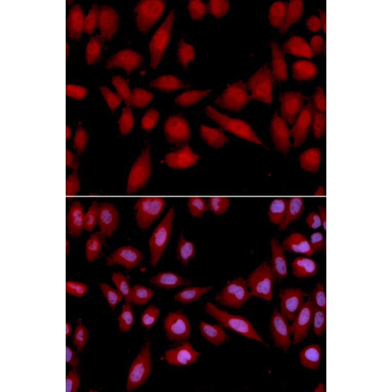 Immunofluorescence - Anti-Proteasome 20S alpha 2/HC3 Antibody (A14015) - Antibodies.com