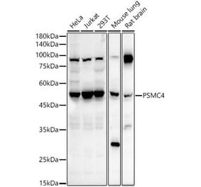 Western Blot - Anti-Tbp7 Antibody (A14016) - Antibodies.com