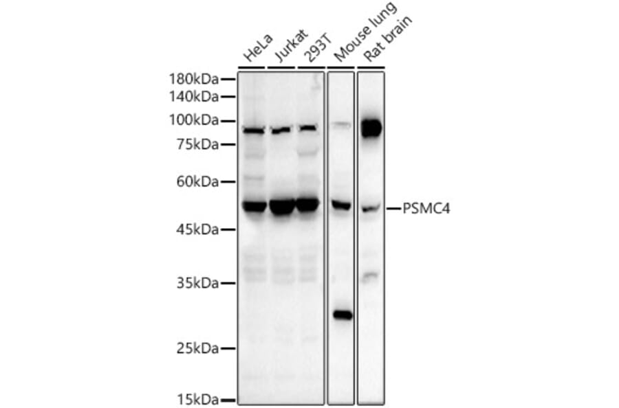Western Blot - Anti-Tbp7 Antibody (A14016) - Antibodies.com