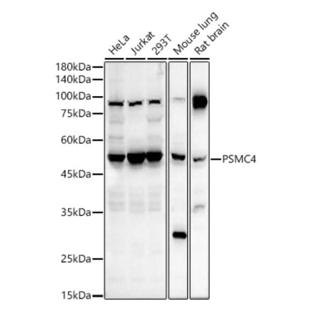 Western Blot - Anti-Tbp7 Antibody (A14016) - Antibodies.com