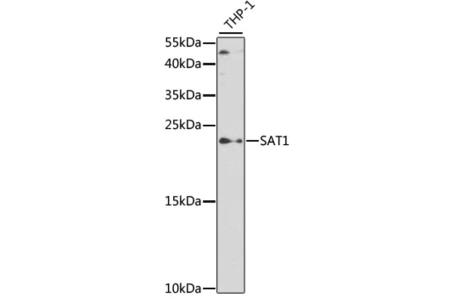 Western Blot - Anti-SAT1 Antibody (A14017) - Antibodies.com