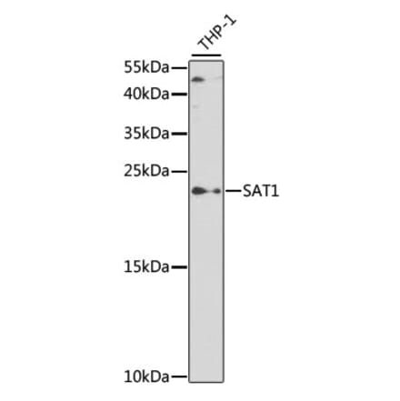 Western Blot - Anti-SAT1 Antibody (A14017) - Antibodies.com