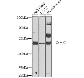 Western Blot - Anti-CaMKII beta Antibody (A14018) - Antibodies.com