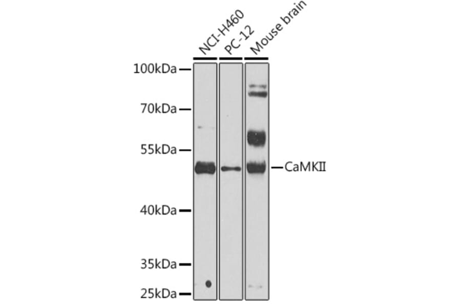 Western Blot - Anti-CaMKII beta Antibody (A14018) - Antibodies.com