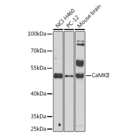 Western Blot - Anti-CaMKII beta Antibody (A14018) - Antibodies.com