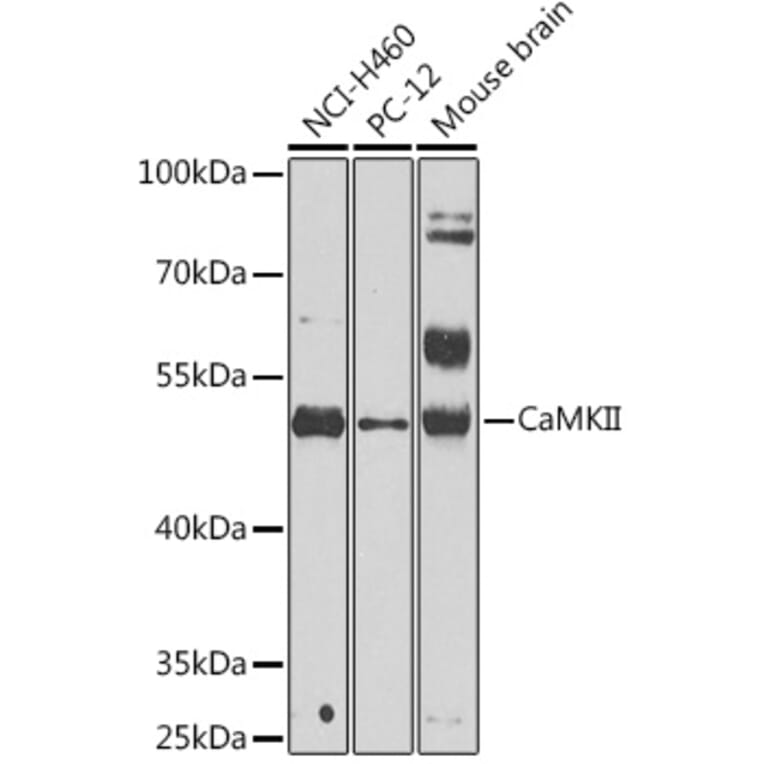 Western Blot - Anti-CaMKII beta Antibody (A14018) - Antibodies.com