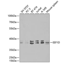 Western Blot - Anti-EEF1D Antibody (A14019) - Antibodies.com