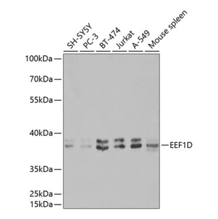 Western Blot - Anti-EEF1D Antibody (A14019) - Antibodies.com