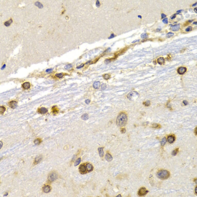 Immunohistochemistry - Anti-EEF1D Antibody (A14019) - Antibodies.com