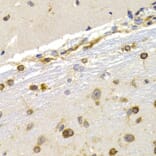 Immunohistochemistry - Anti-EEF1D Antibody (A14019) - Antibodies.com