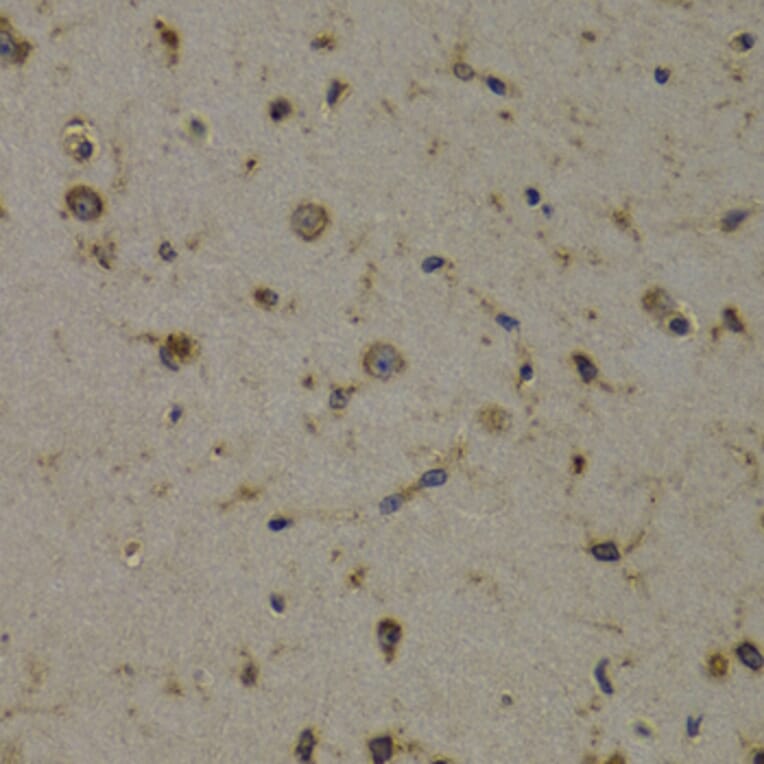 Immunohistochemistry - Anti-EEF1D Antibody (A14019) - Antibodies.com