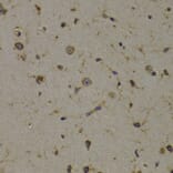 Immunohistochemistry - Anti-EEF1D Antibody (A14019) - Antibodies.com