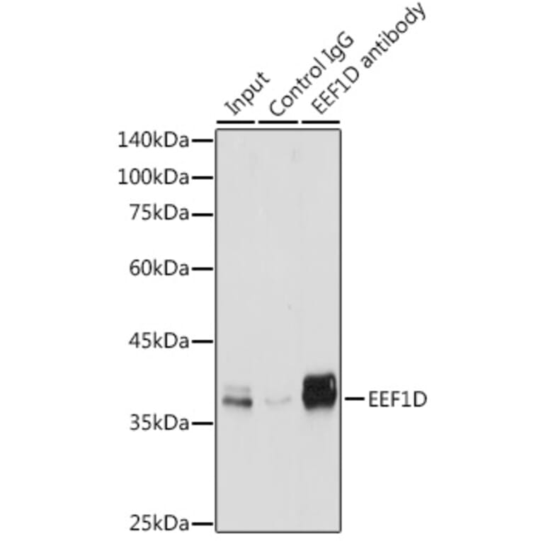 Western Blot - Anti-EEF1D Antibody (A14019) - Antibodies.com