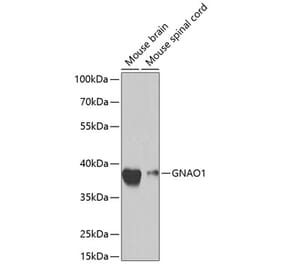 Western Blot - Anti-GNAO1 Antibody (A14020) - Antibodies.com