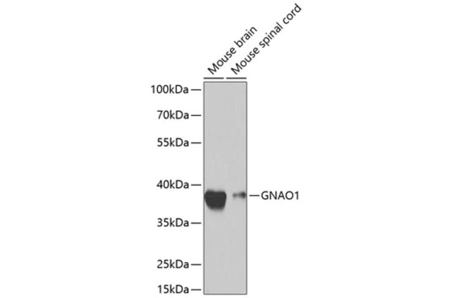 Western Blot - Anti-GNAO1 Antibody (A14020) - Antibodies.com