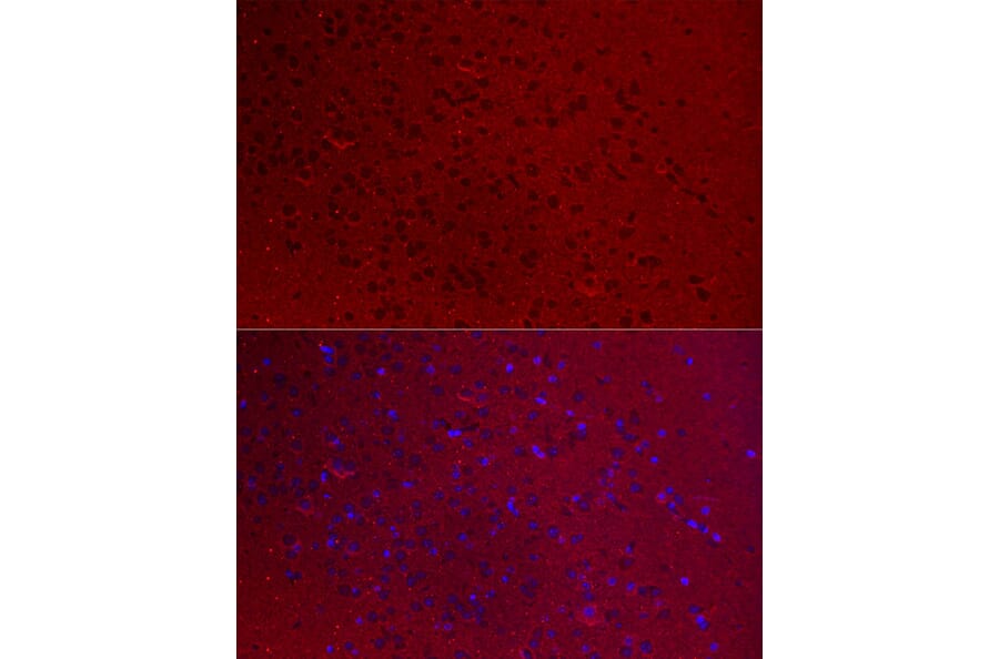 Immunofluorescence - Anti-GNAO1 Antibody (A14020) - Antibodies.com