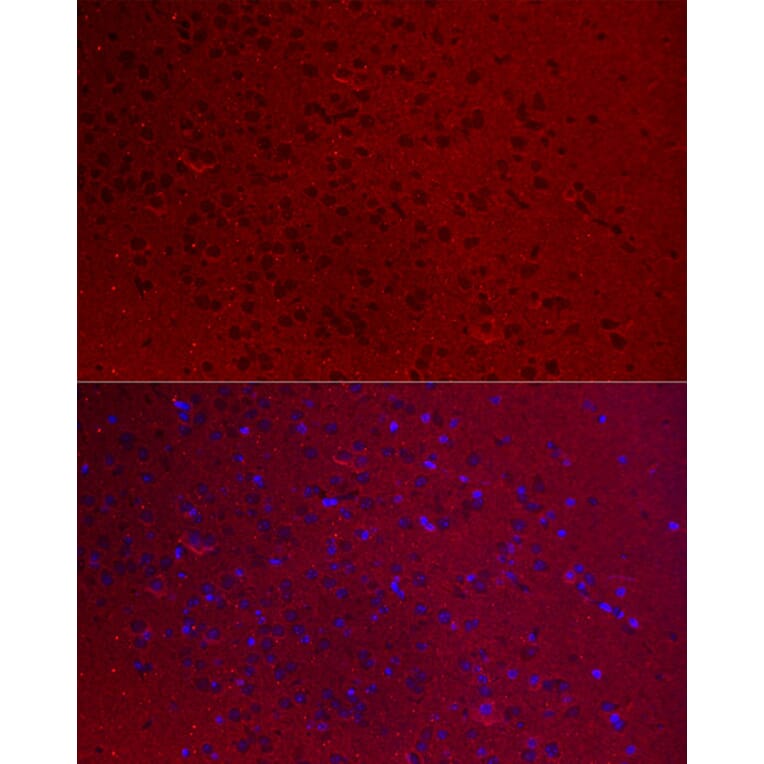 Immunofluorescence - Anti-GNAO1 Antibody (A14020) - Antibodies.com