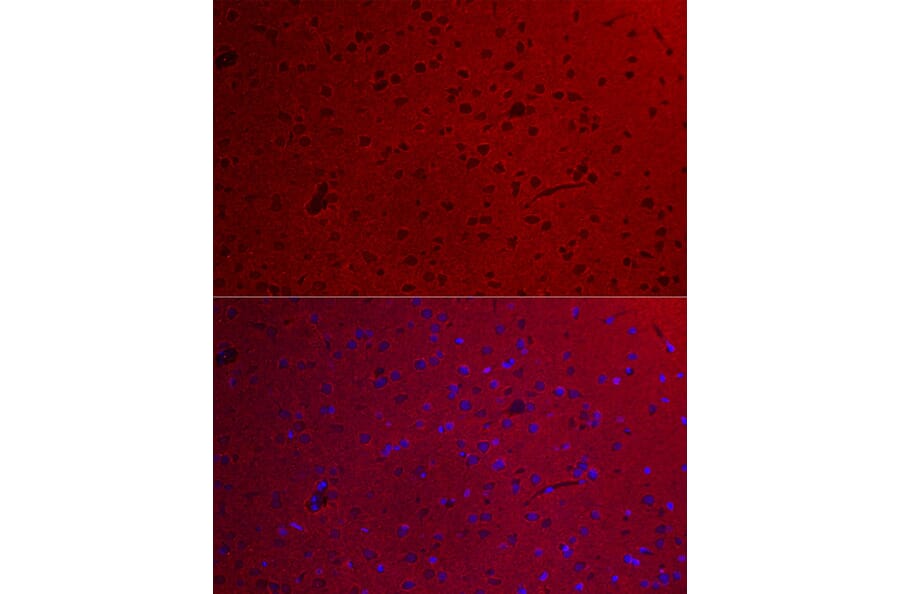 Immunofluorescence - Anti-GNAO1 Antibody (A14020) - Antibodies.com