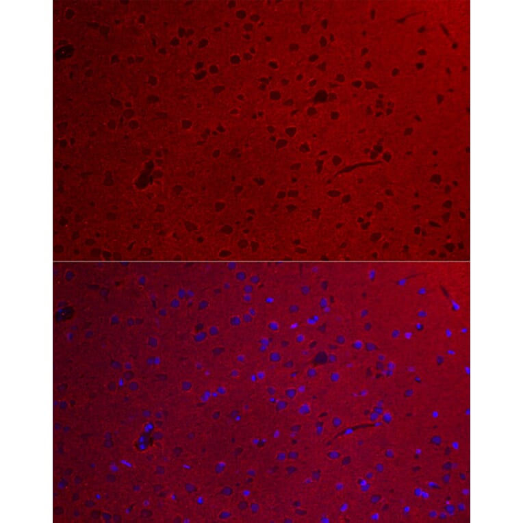 Immunofluorescence - Anti-GNAO1 Antibody (A14020) - Antibodies.com
