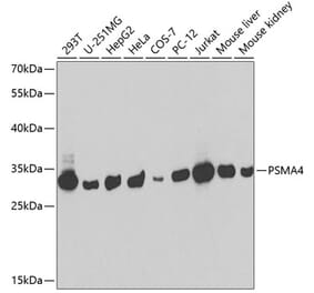 Western Blot - Anti-PSMA4 Antibody (A14021) - Antibodies.com
