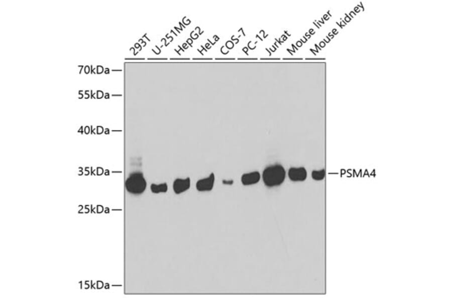 Western Blot - Anti-PSMA4 Antibody (A14021) - Antibodies.com