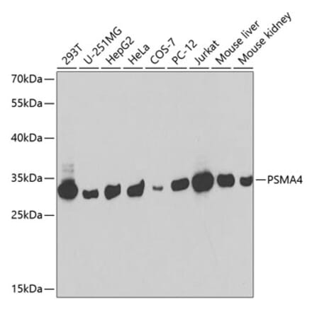 Western Blot - Anti-PSMA4 Antibody (A14021) - Antibodies.com