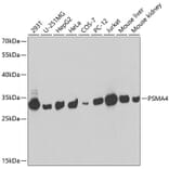 Western Blot - Anti-PSMA4 Antibody (A14021) - Antibodies.com