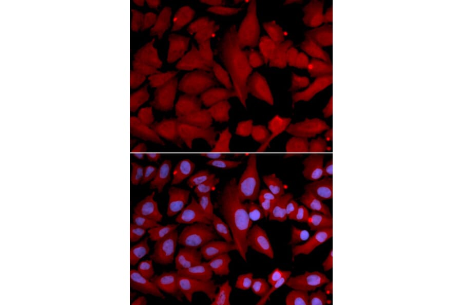 Immunofluorescence - Anti-PSMA4 Antibody (A14021) - Antibodies.com