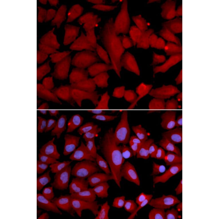 Immunofluorescence - Anti-PSMA4 Antibody (A14021) - Antibodies.com