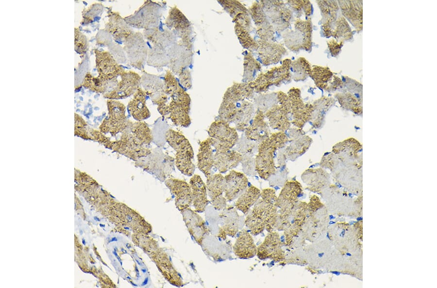 Immunohistochemistry - Anti-Hsp22/HSPB8 Antibody (A14023) - Antibodies.com