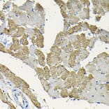 Immunohistochemistry - Anti-Hsp22/HSPB8 Antibody (A14023) - Antibodies.com