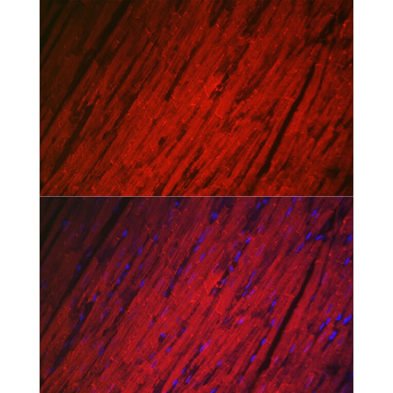 Immunofluorescence - Anti-Hsp22/HSPB8 Antibody (A14023) - Antibodies.com