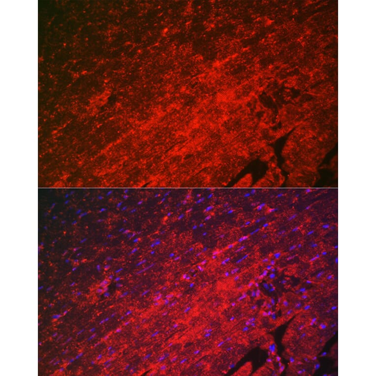 Immunofluorescence - Anti-Hsp22/HSPB8 Antibody (A14023) - Antibodies.com