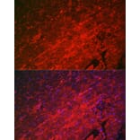 Immunofluorescence - Anti-Hsp22/HSPB8 Antibody (A14023) - Antibodies.com