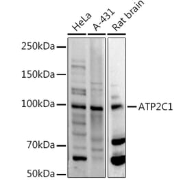 Western Blot - Anti-ATP2C1 Antibody (A14024) - Antibodies.com