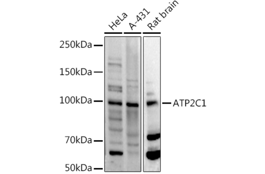 Western Blot - Anti-ATP2C1 Antibody (A14024) - Antibodies.com