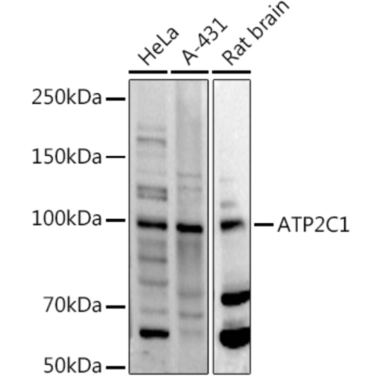 Western Blot - Anti-ATP2C1 Antibody (A14024) - Antibodies.com